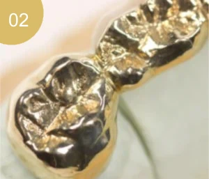 Selling dental gold in The Hague